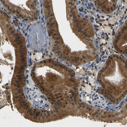 Asialoglycoprotein Receptor 2 Antibody, Novus Biologicals:Antibodies:Primary